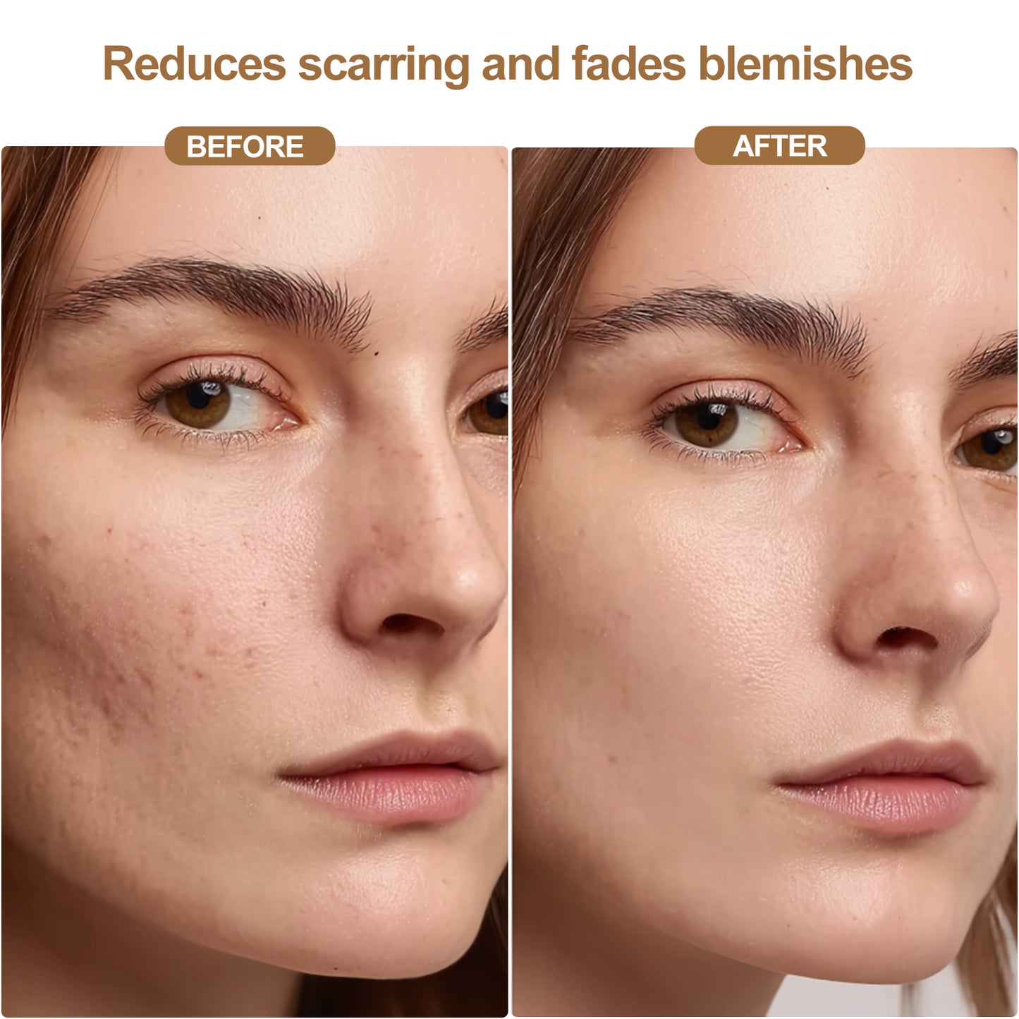 WellEver Wireless Red Light LED Therapy Mask For Face